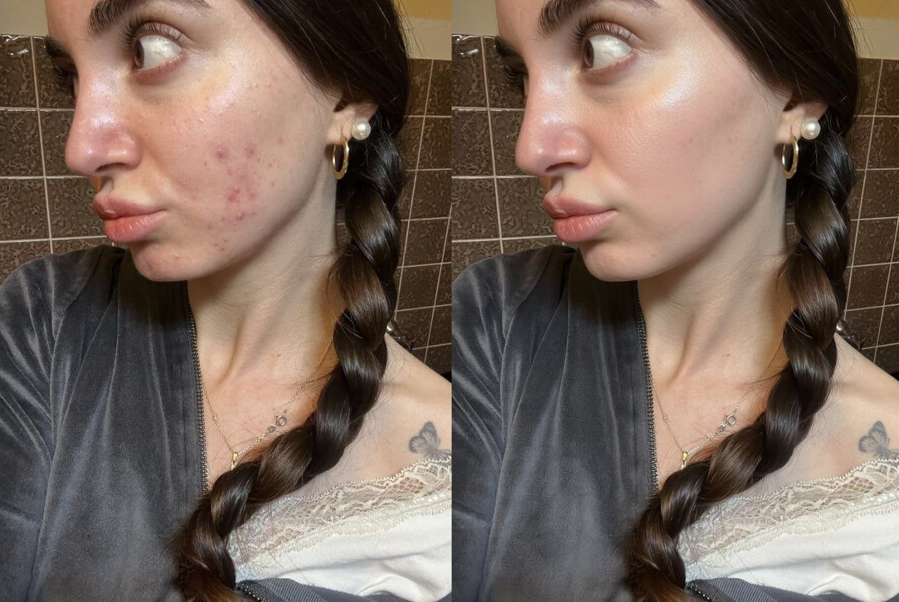 Skin Retouch - portrait enhancement