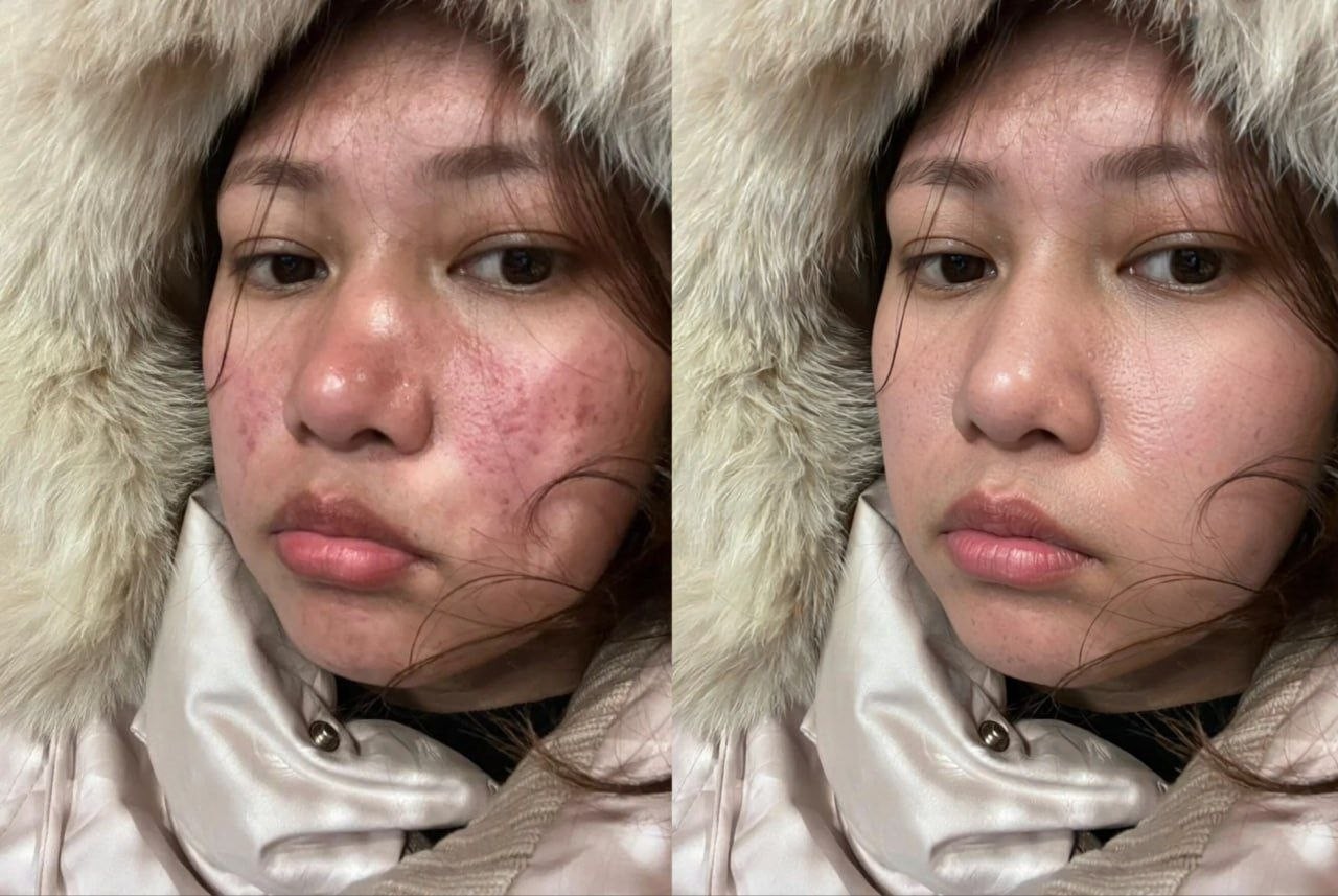 Skin Retouch - complexion smoothing